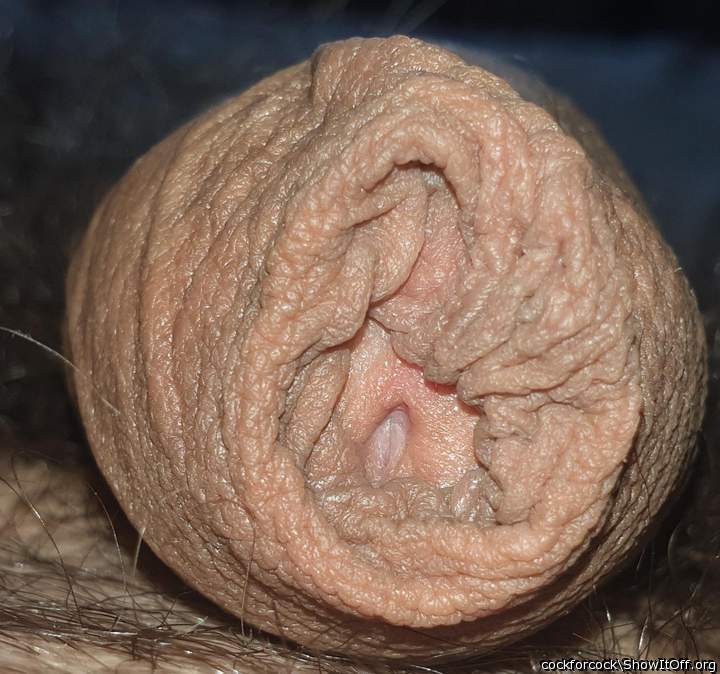 foreskin close-up