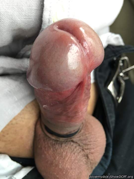 Photo of a purple headed monster from ilovemydick