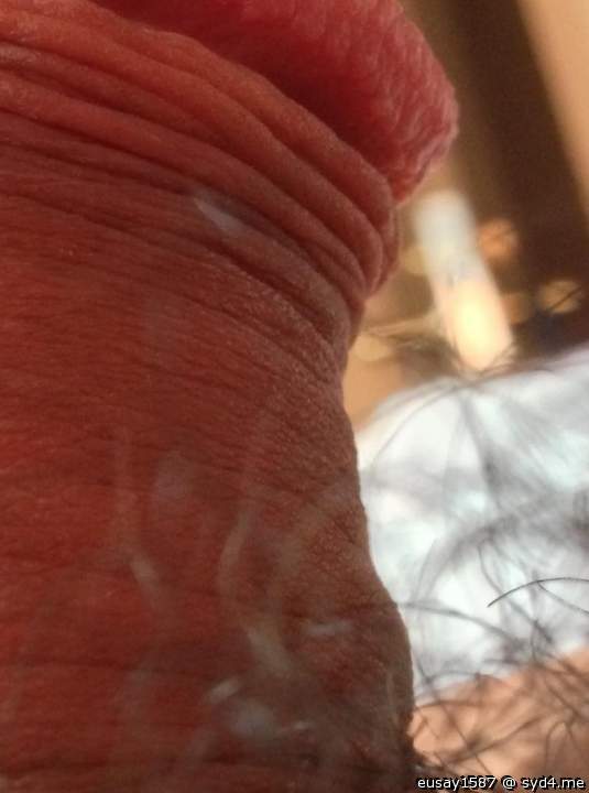 Photo of a penis from eusay1587