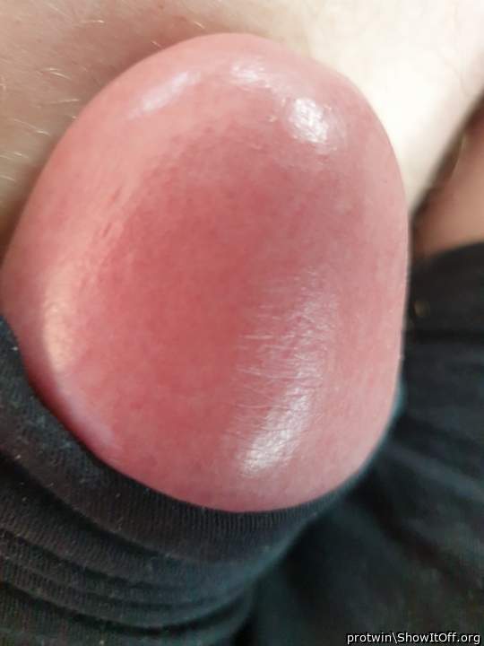 Photo of a short leg from protwin