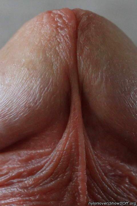 Photo of a prick from nylonlover