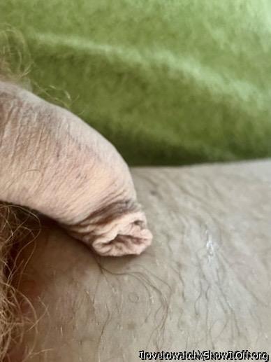 Foreskin