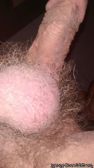 hairy balls