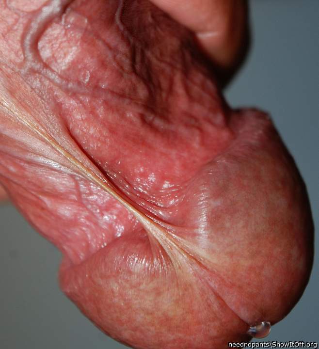 Frenulum and precum