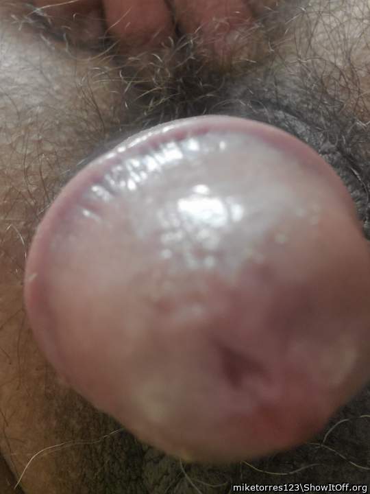 Photo of a private part from miketorres123