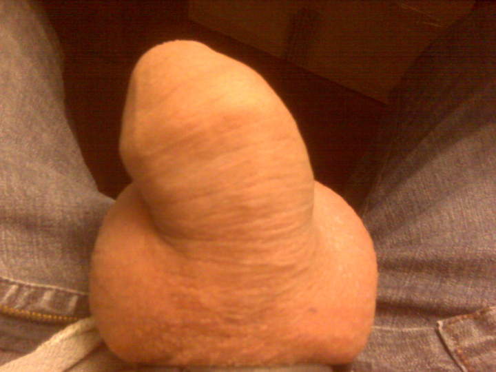 Photo of a short leg from madras