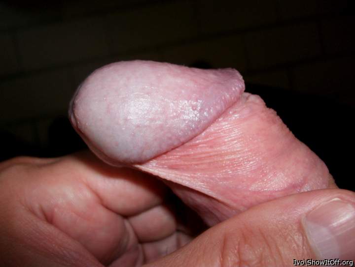 Glans sideview with corona, frenulum and retracted foreskin