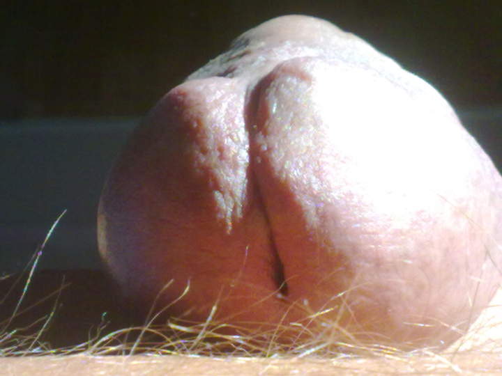 Photo of a snake from padda