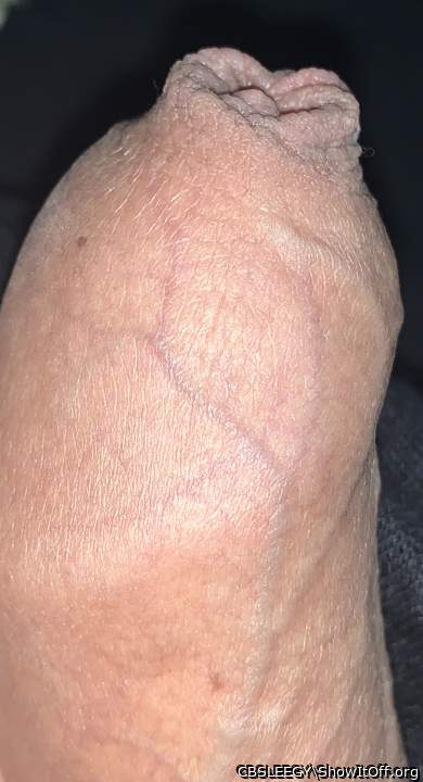 Skin is bit dry but nice detail with the moles..
