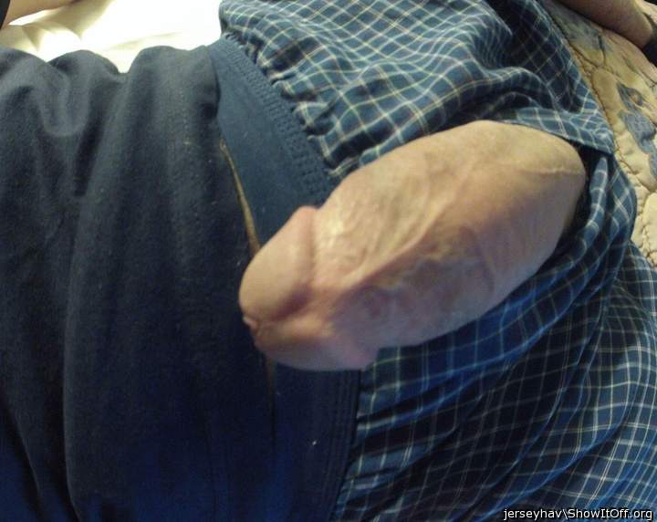 Photo of a middle leg from jerseyhav