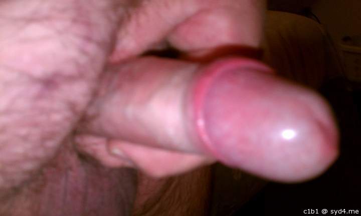 Photo of a penile from c1b1