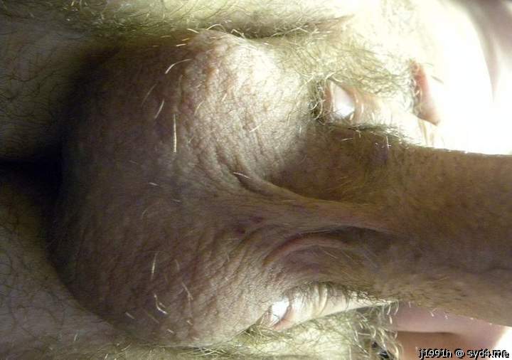 Testicles Photo from J1991h
