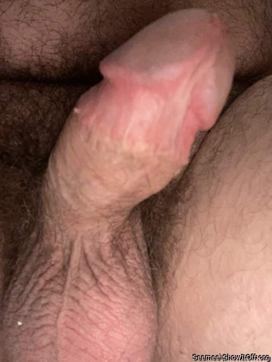 Photo of a private part from Seemee