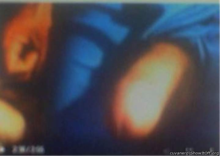 Photo of a penile from cuvanero