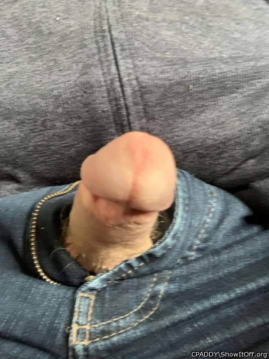 My Circumcised Dick-Do you like it?