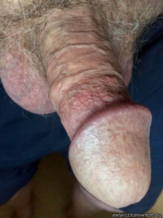 Beautiful head and circumcision   