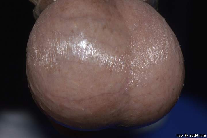 Testicles Photo from ryo