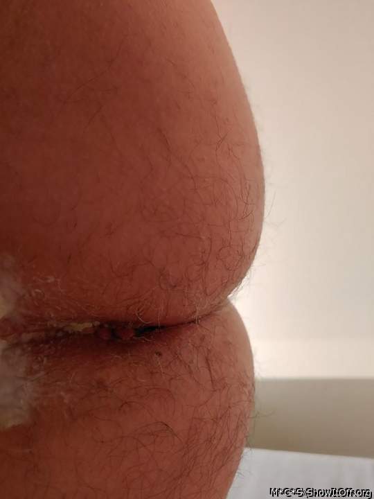 Photo of a short leg from M*C*S