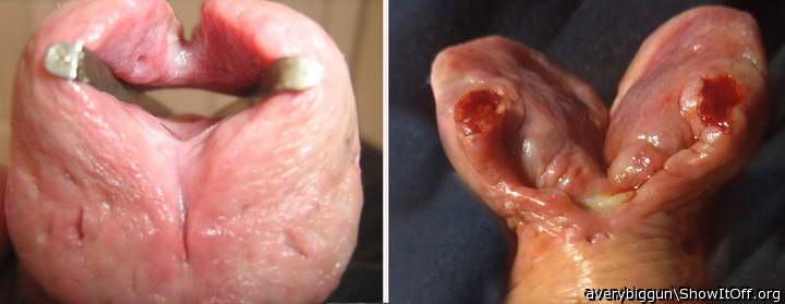 Before & After