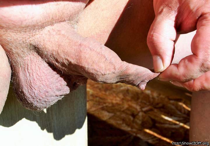 My long Foreskin
