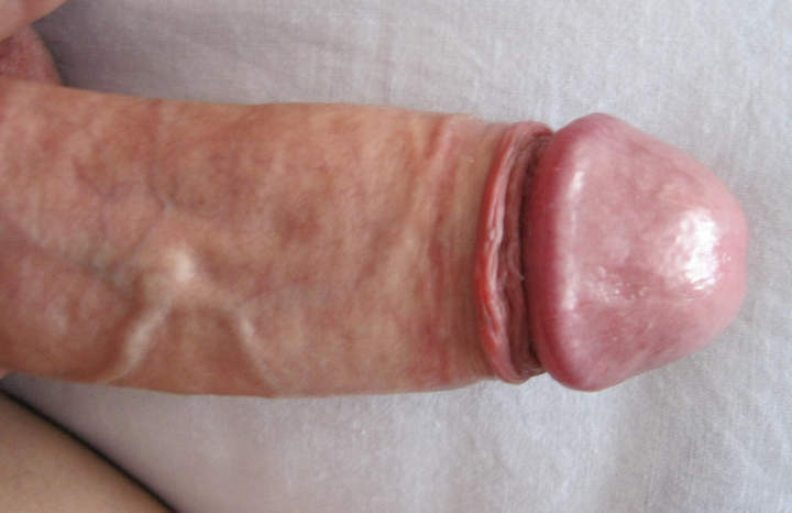 Photo of a one-eyed monster from stinger432
