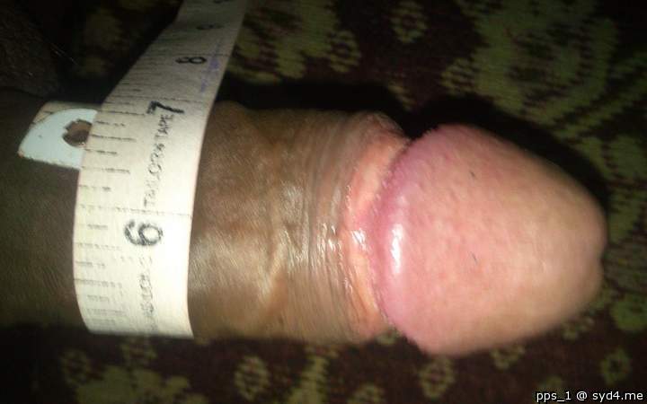 Photo of a middle leg from pps_1