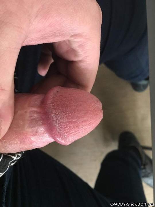 My Circumcised Dick-Do you like it?