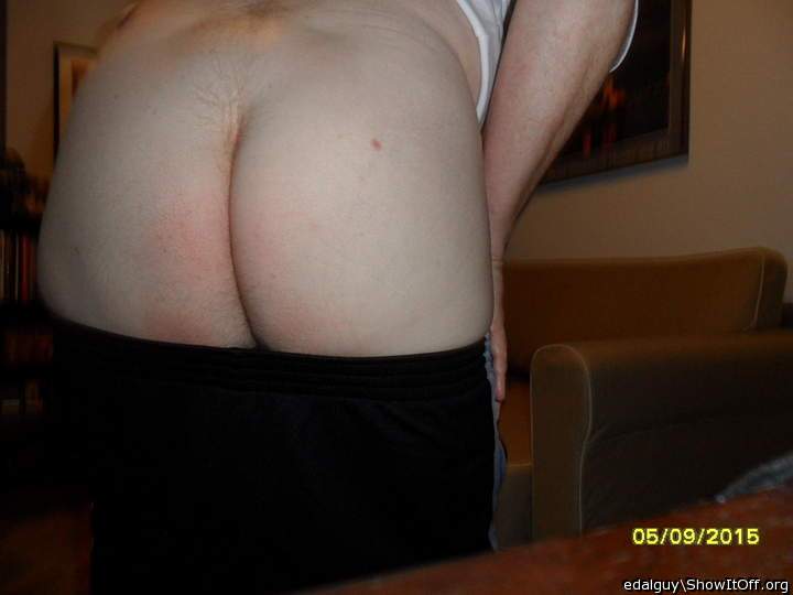 Sweet cheeks...