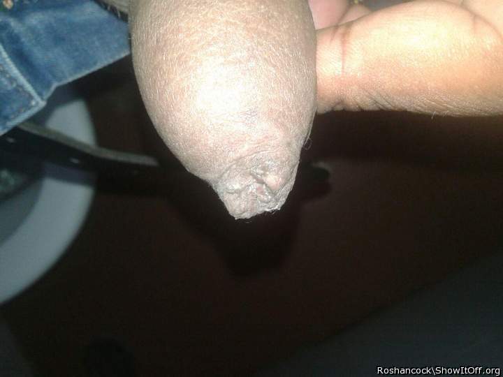 Photo of a middle leg from roshancock