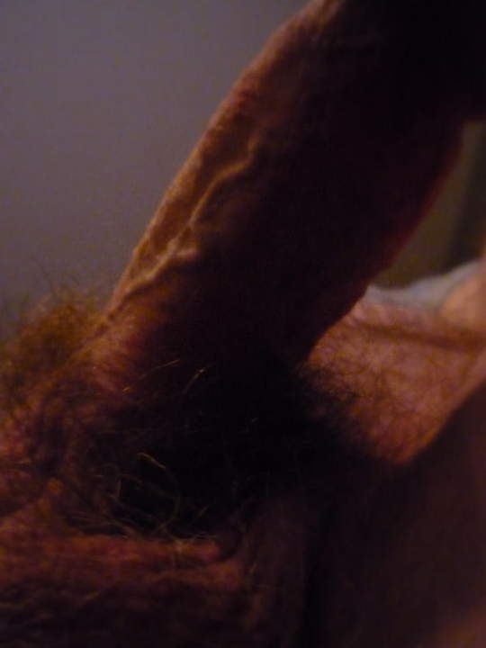 Photo of a penile from cumnut89