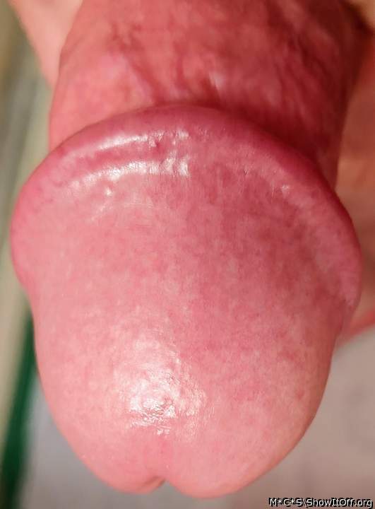 Photo of a private part from M*C*S
