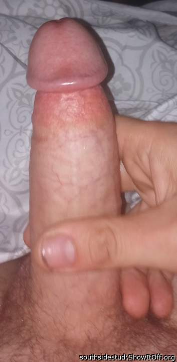 Photo of a short leg from southsidestud