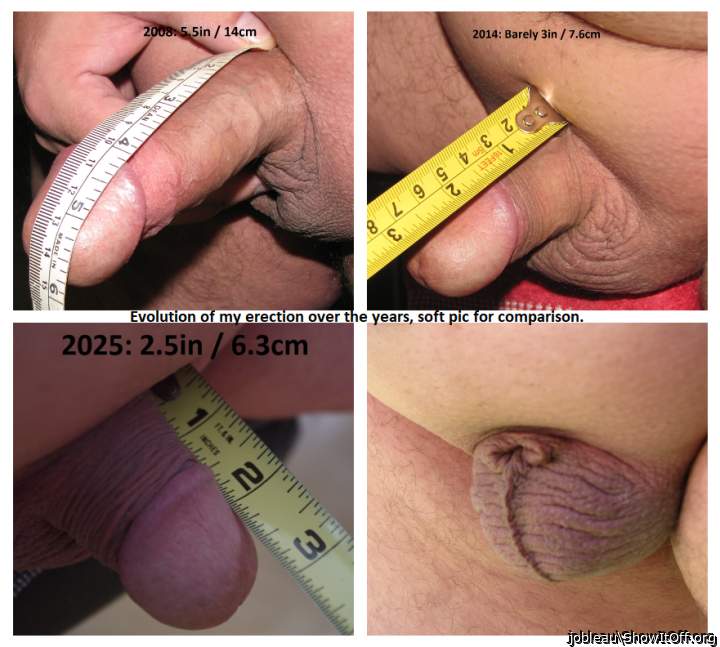 Photo of a short leg from jobleau