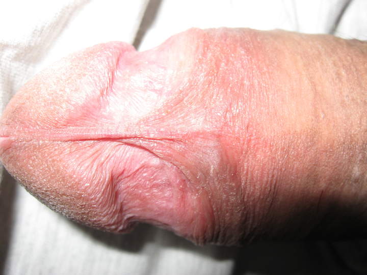 Photo of a love muscle from porlokino