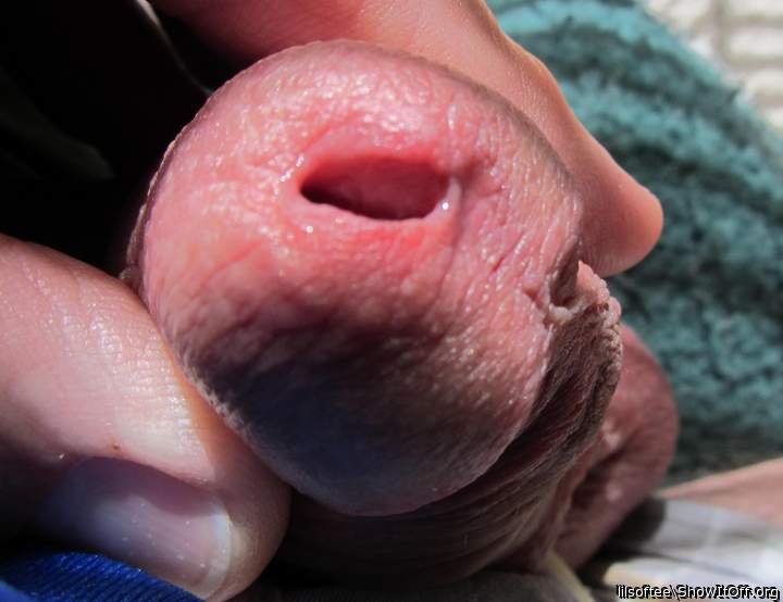Super closeup picture. Great view.