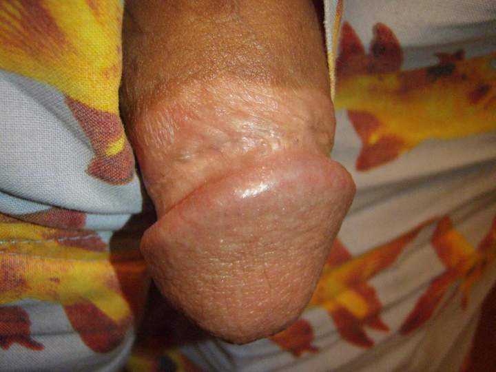 Photo of a third leg from lilsoftee