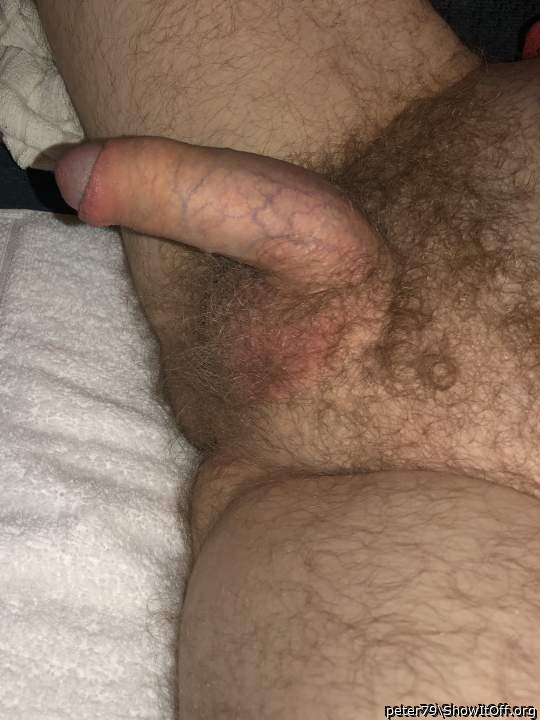 Photo of a penis from peter79
