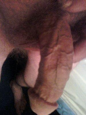 bone2