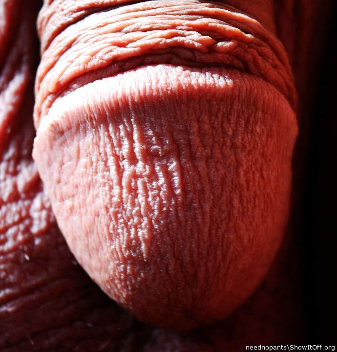 Photo of a private part from neednopants