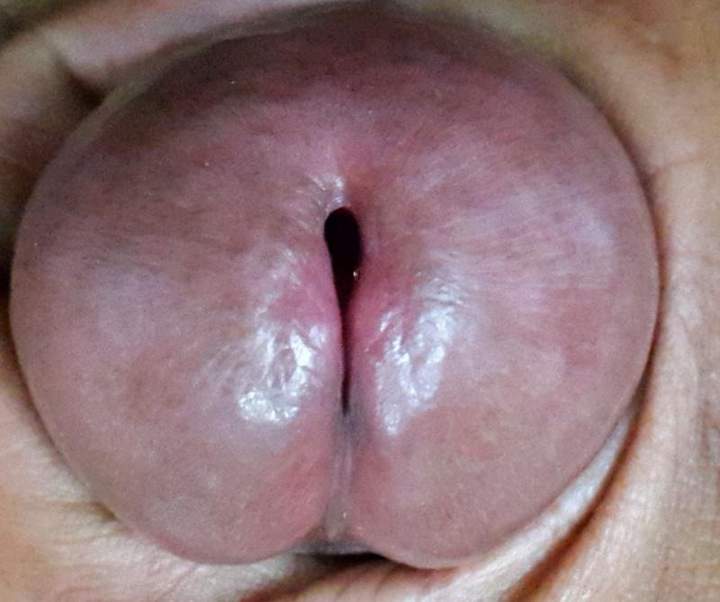 Beautiful piss slit.