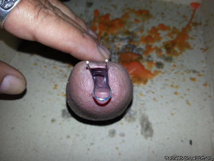 Wax Filling