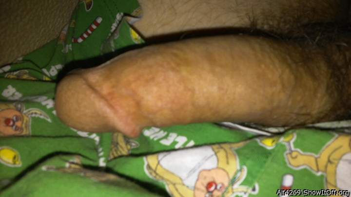 Photo of a short leg from Alf4269