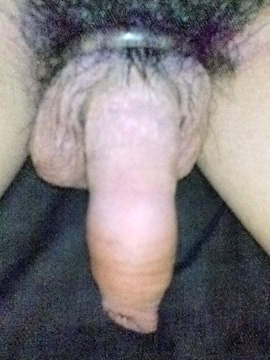Photo of a middle leg from DEXXX3