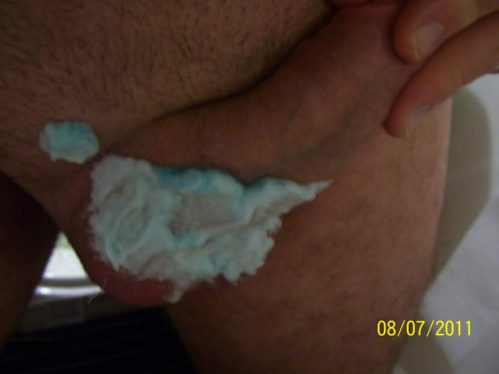 Photo of a private part from JUSTTOPLAY75