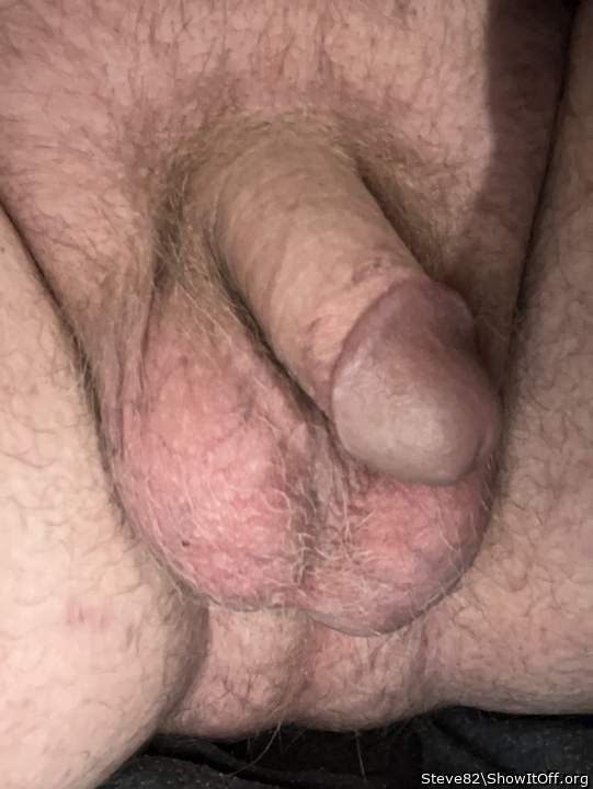 Photo of a short leg from Steve82