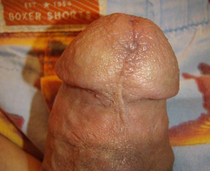 Photo of a middle leg from lilsoftee