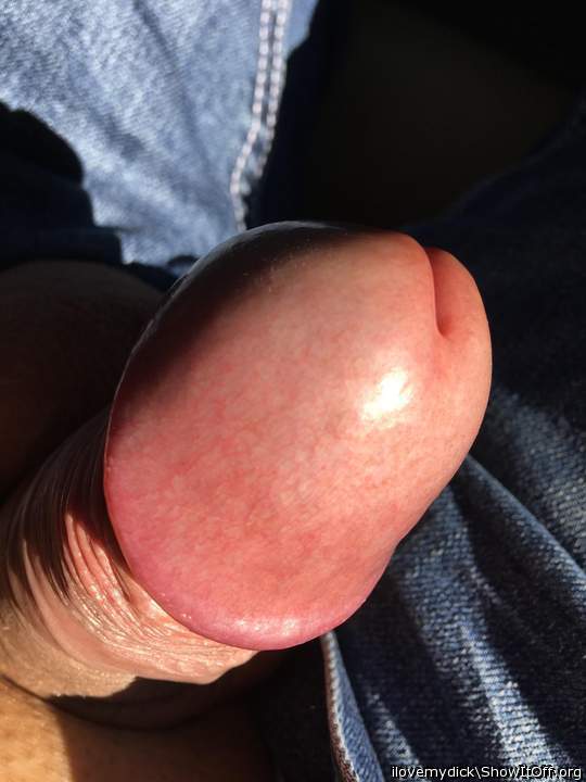 Photo of a one-eyed monster from ilovemydick