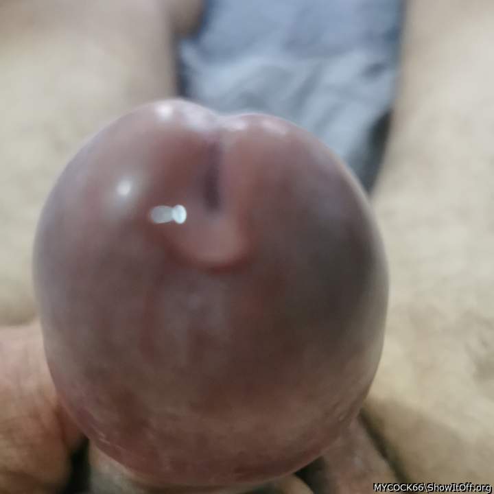 Photo of a private part from MYCOCK66