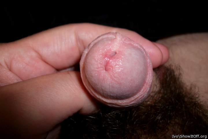 Half-nude glans with frenulum