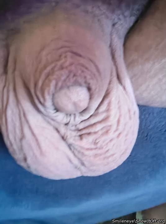 Photo of a third leg from Smileneye